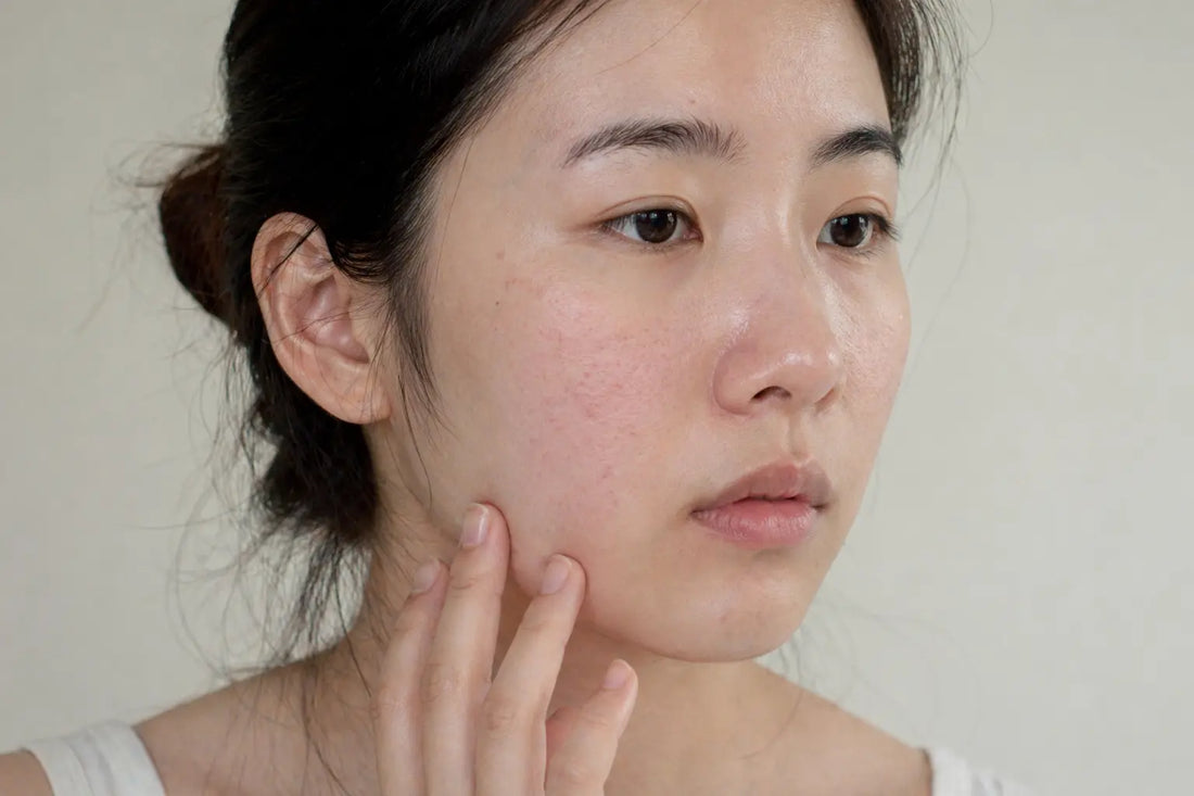 💧Comment réparer une peau abîmée ?