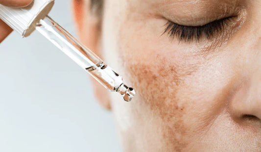 ✨Les meilleurs ingrédients coréens contre les taches pigmentaires et l’hyperpigmentation