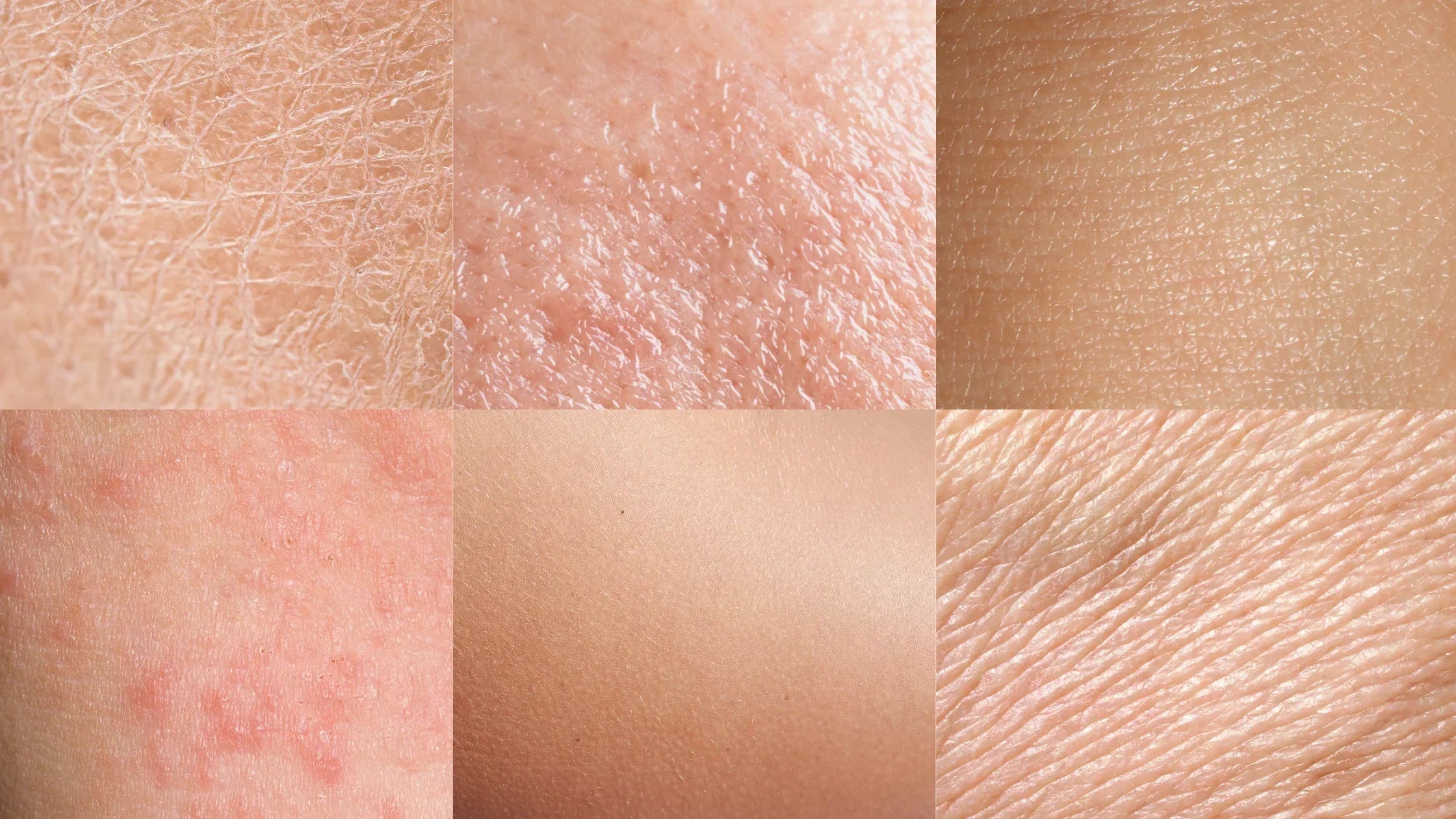 🧬Skincare coréen : ce qui ne convient pas à tous les types de peau