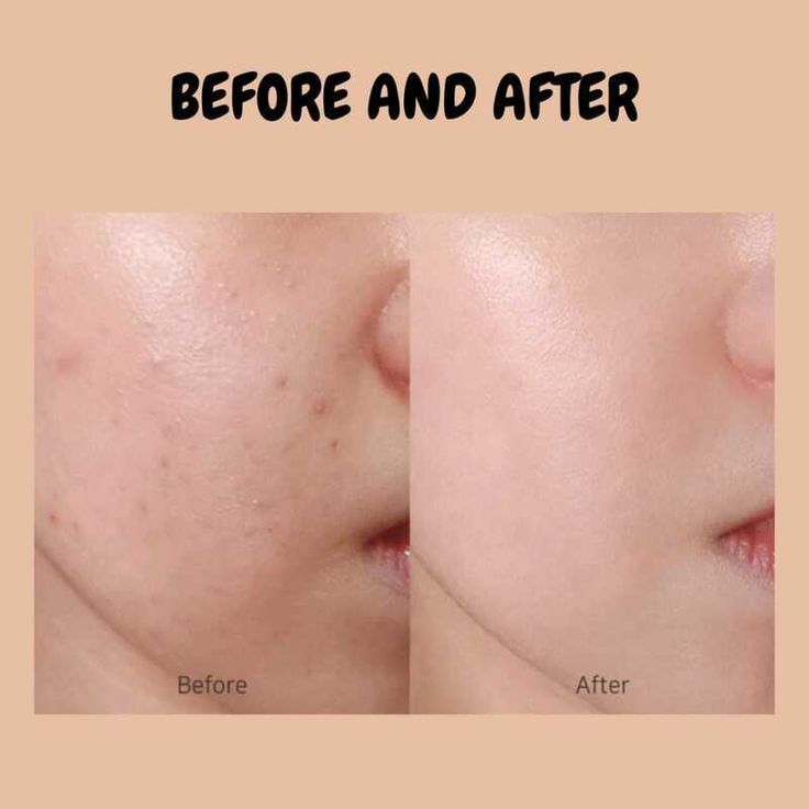 Medicube - Masque gel au collagène rose PDRN SkinGlow