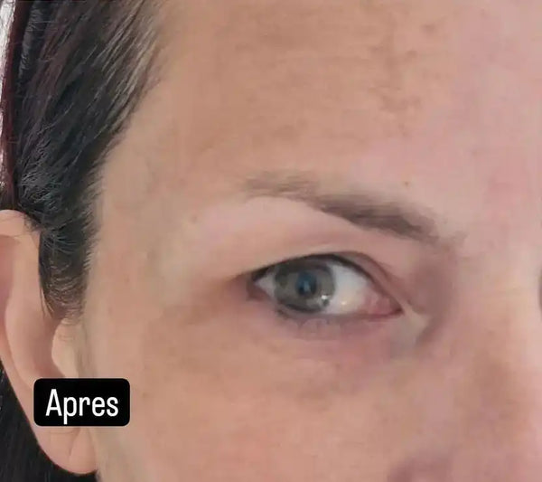 Après
