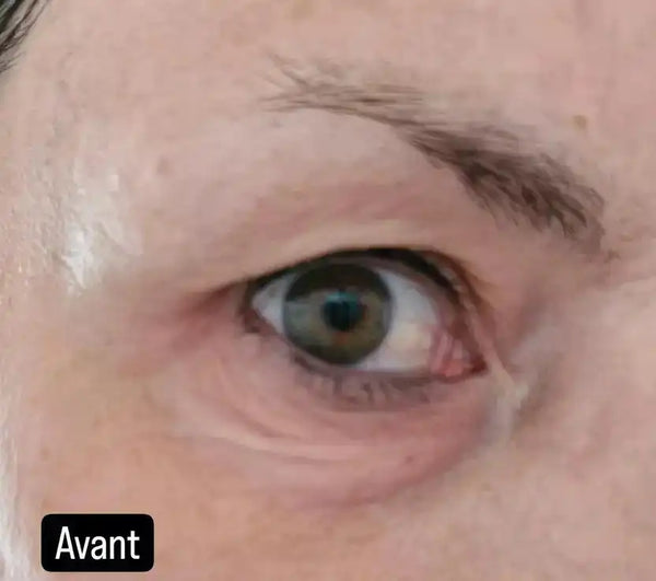 Avant