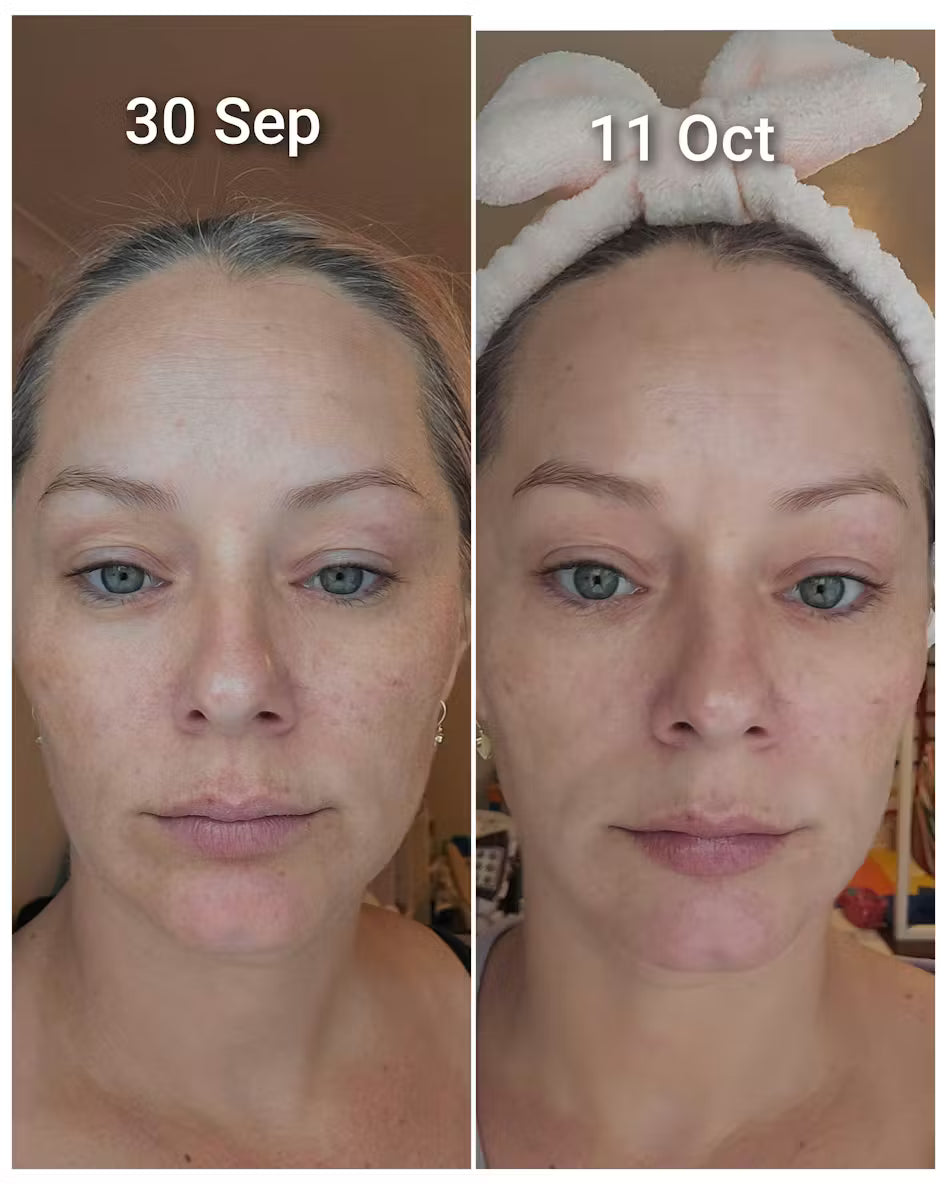 Haruharu Wonder – Crème hyaluronique au riz noir