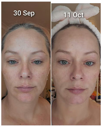 Haruharu Wonder – Crème hyaluronique au riz noir