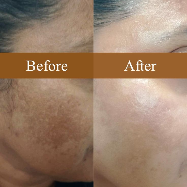 Medicube - Sérum TXA Niacinamide SkinGlow