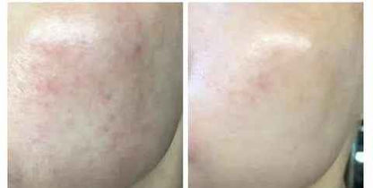 HaruHaru Wonder - Lotion tonique à l'acide hyaluronique et au riz noir