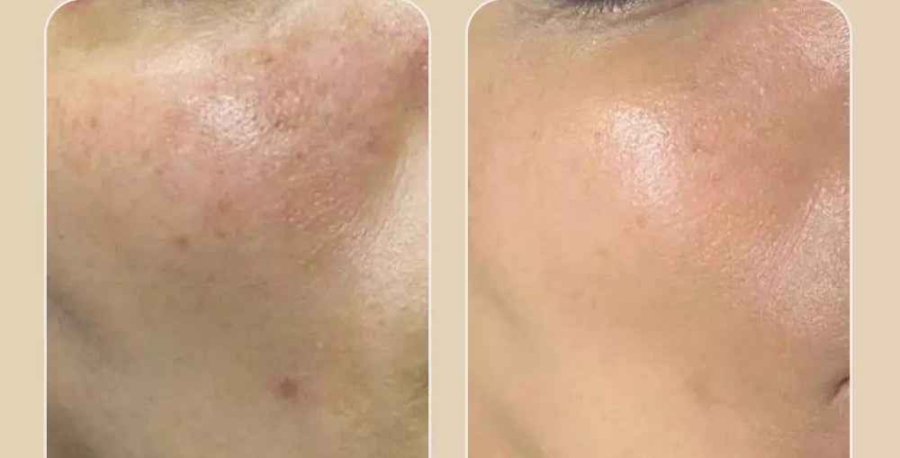 Medipeel peptide tox bor toner SkinGlow