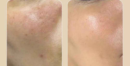 Medipeel peptide tox bor toner SkinGlow