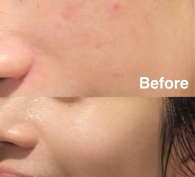 Torriden – Dive-in Low Soin booster à l'acide hyaluronique