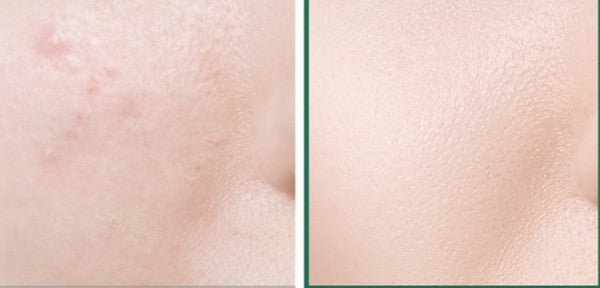 Mixsoon Centella Asiatica Toner SkinGlow