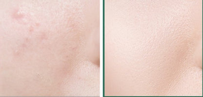 Mixsoon Centella Asiatica Toner SkinGlow
