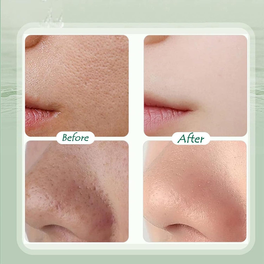 Beauty of Joseon Centella Asiatica Soothing Mask SkinGlow