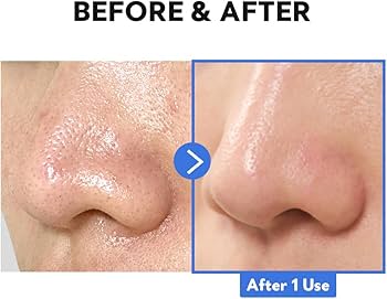 Tirtir - skin milk Toner SkinGlow