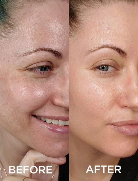 Medicube - Sérum Booster d'Éclat SkinGlow