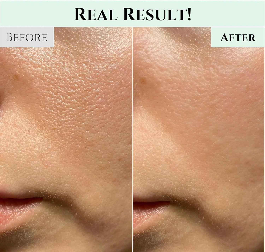 Beauty of Joseon –  Baume nettoyant éclat