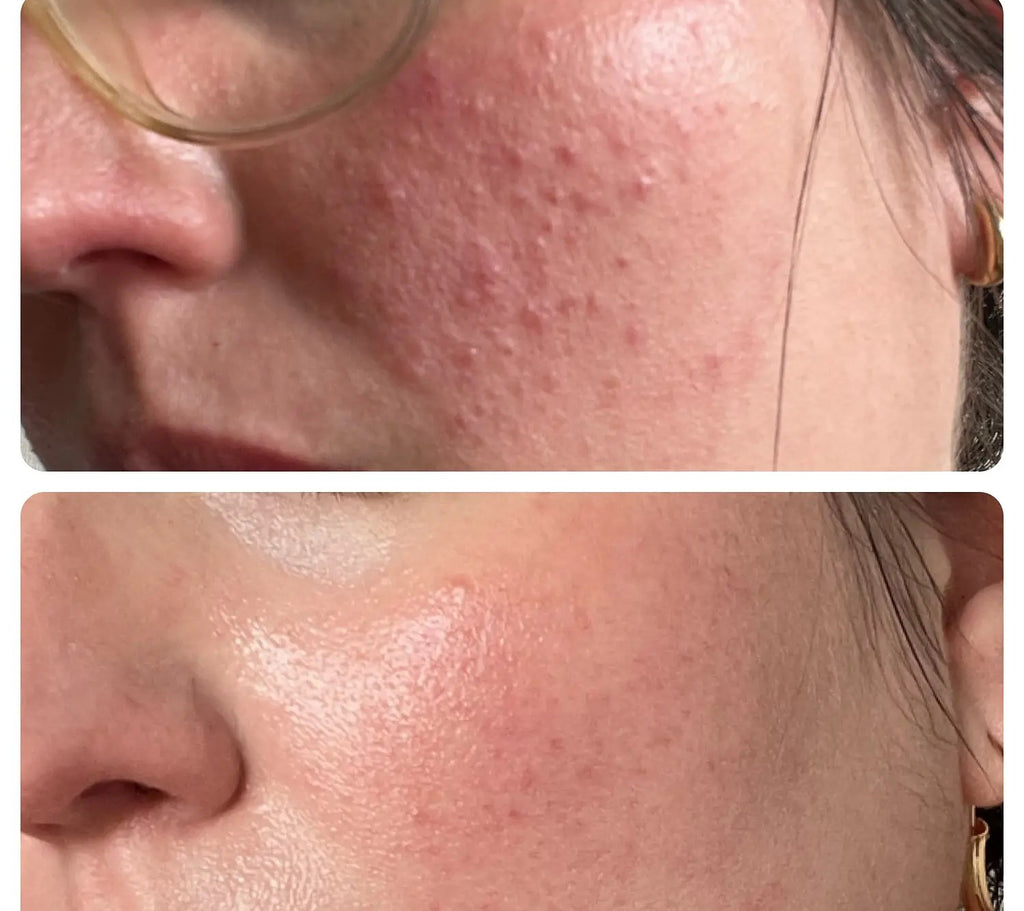 Skin1004 Centella Madagascar Soothing Cream 30ml SkinGlow