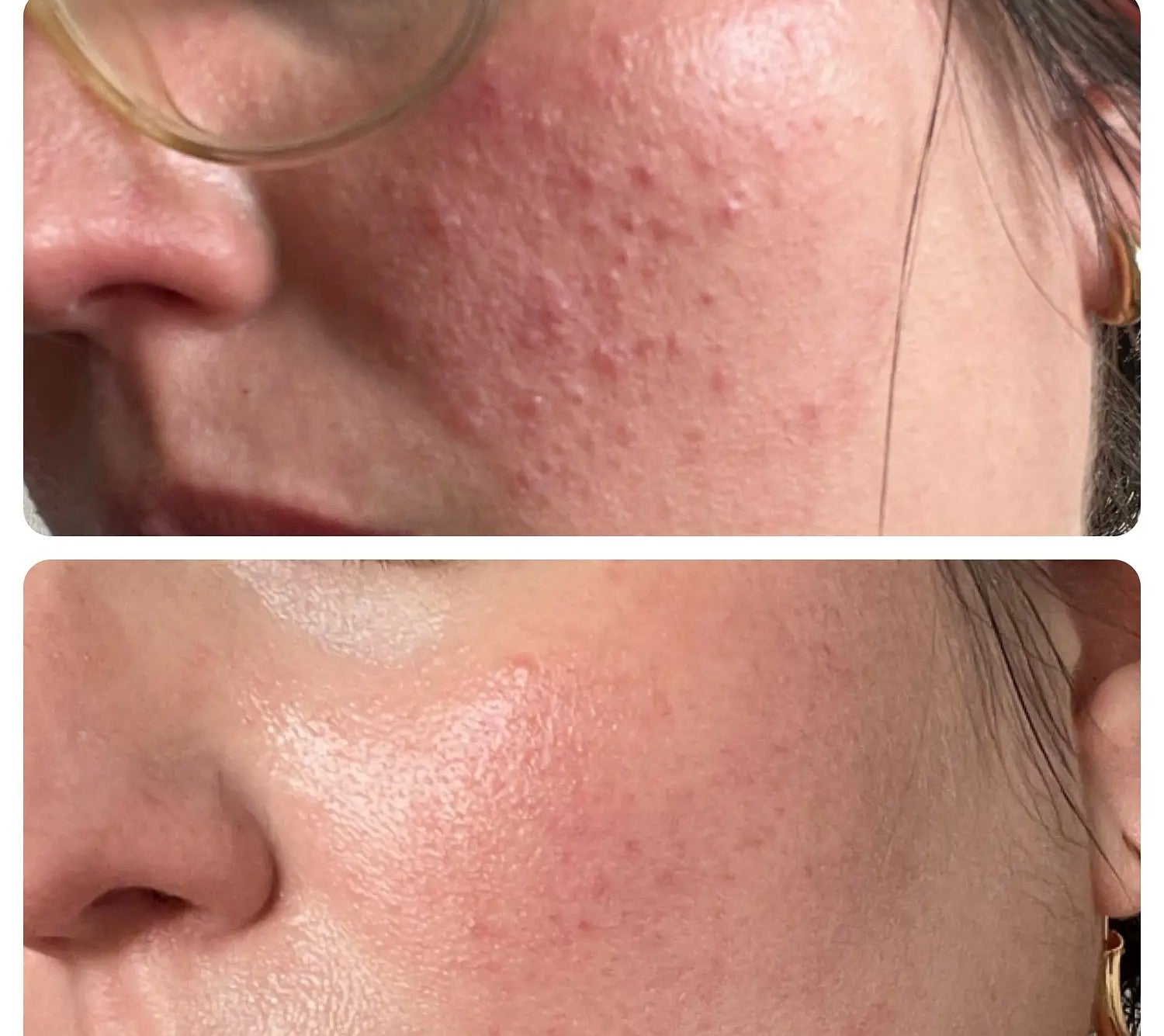 Skin1004 Centella Madagascar Soothing Cream 30ml SkinGlow