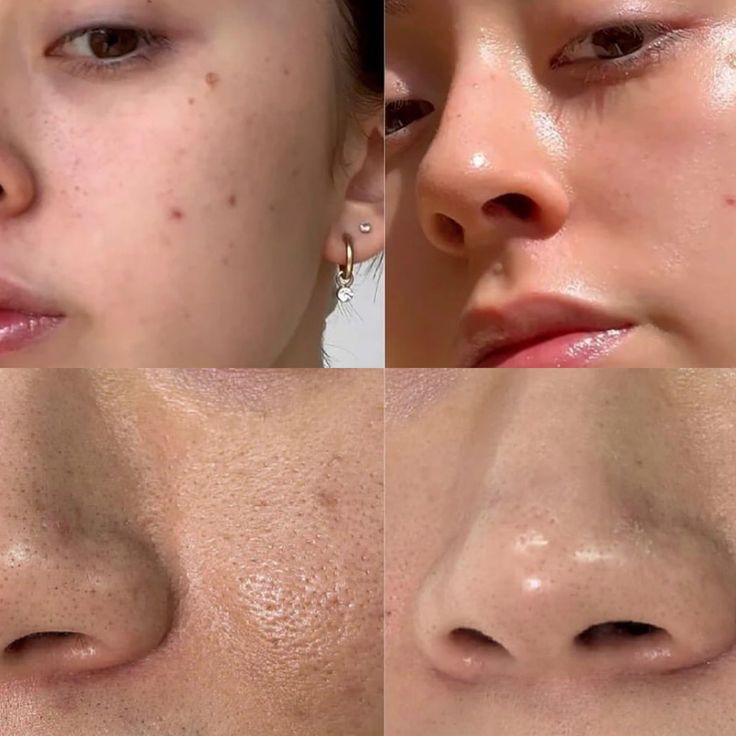 Medicube - PDRN Pink Collagen Gel Mask SkinGlow