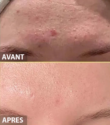 COSRX Advanced Snail 96 Mucin Power Essence SkinGlow