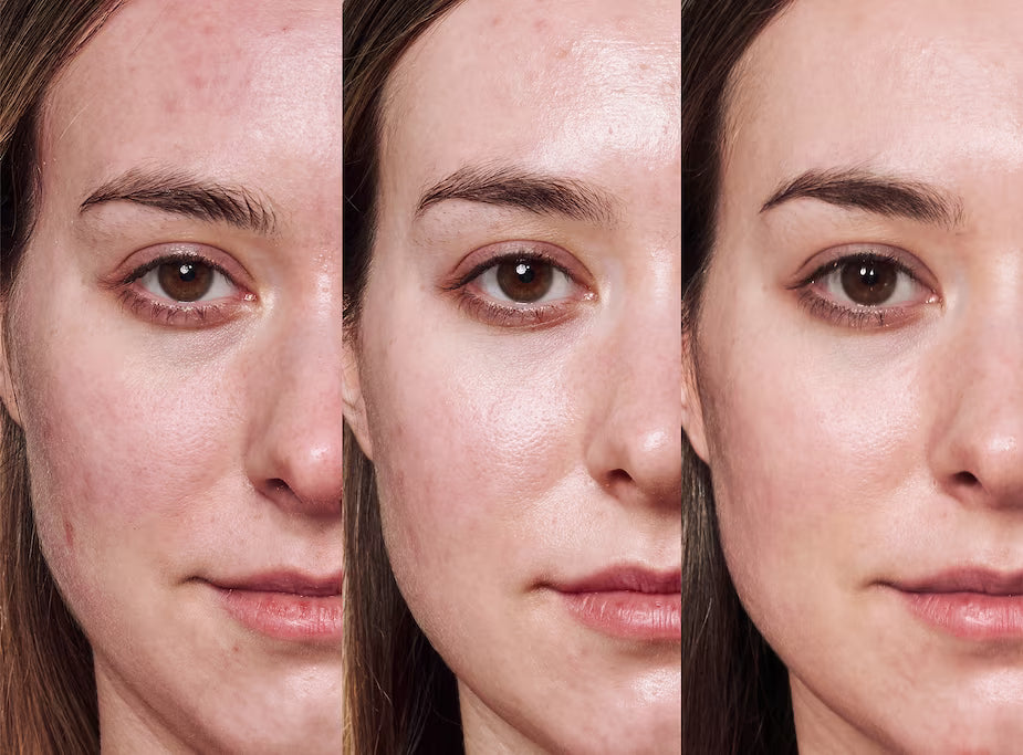 Torriden - Crème à l'acide hyaluronique à faible poids moléculaire