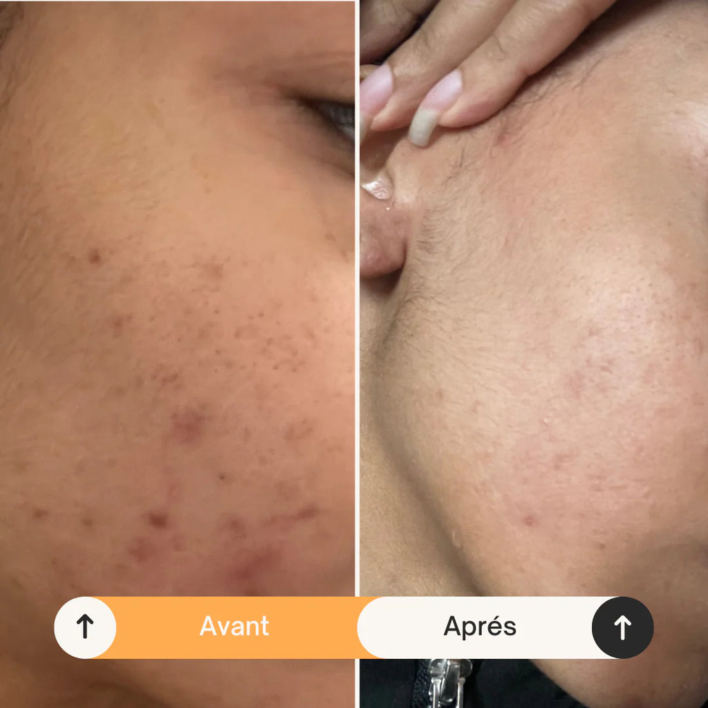 Medicube - Masque éclaircissant à l'acide kojique et au curcuma SkinGlow