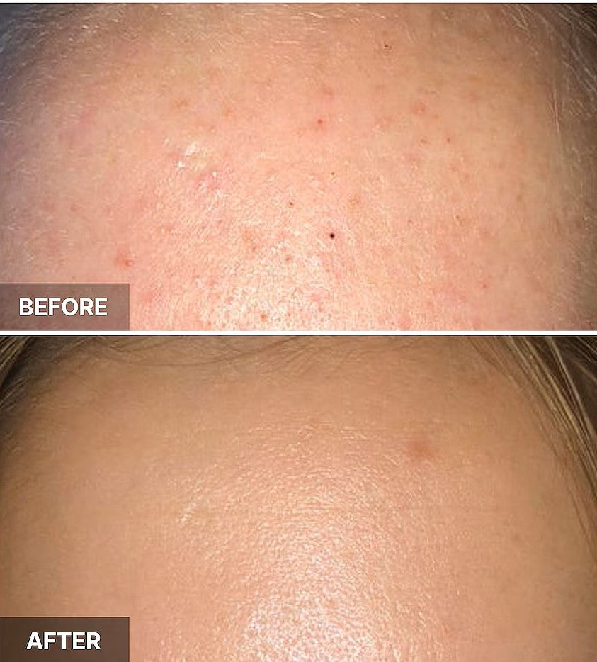 Cosrx AHA 7 Whitehead Power Liquid SkinGlow