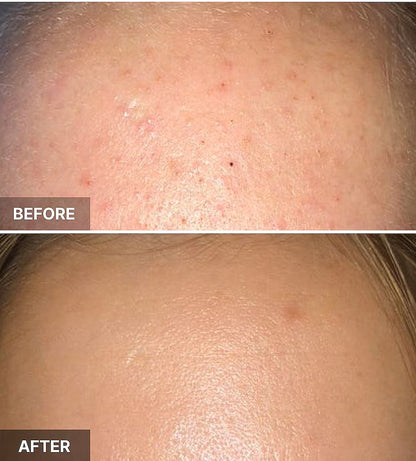 Cosrx AHA 7 Whitehead Power Liquid SkinGlow