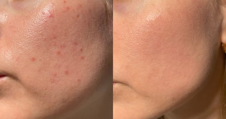 Tirtir SOS Serum - Sérum Réparateur SkinGlow