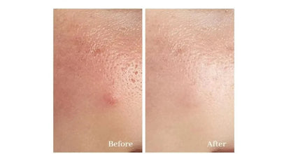 Dr Althea 345 Relief Cream SkinGlow