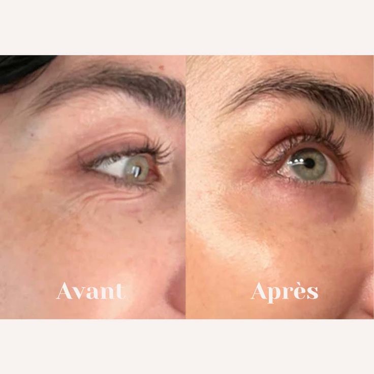 Medicube - Sérum PDRN aux peptides Pink SkinGlow