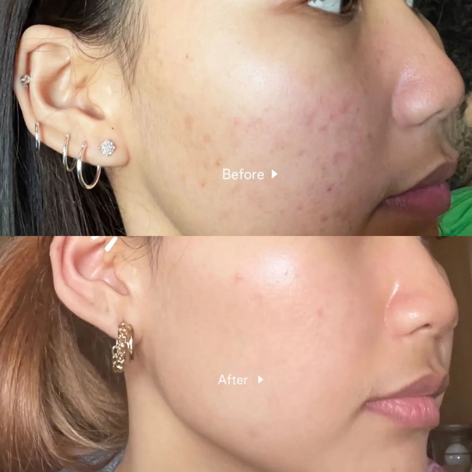 Skin1004 Madagascar Centella Tea-Trica Relief Ampoule SkinGlow