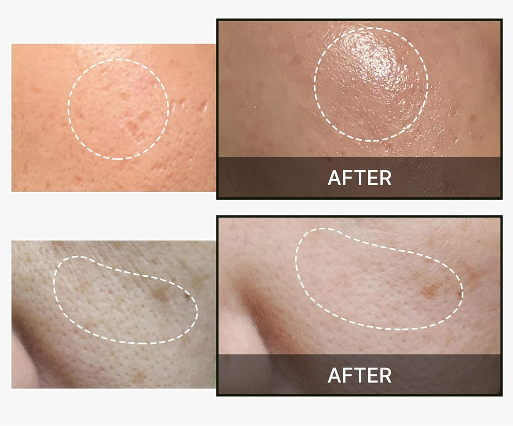 Medicube One Day Exosome Shot 2000 SkinGlow