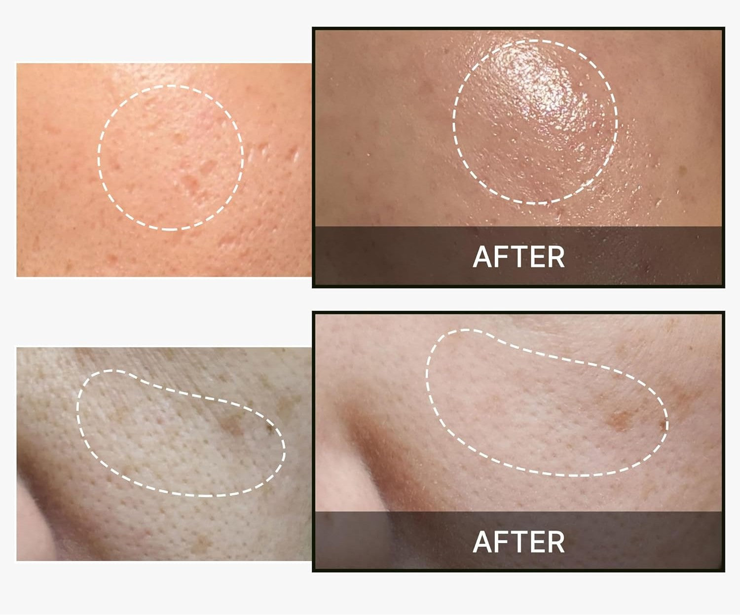 Medicube One Day Exosome Shot 2000 SkinGlow