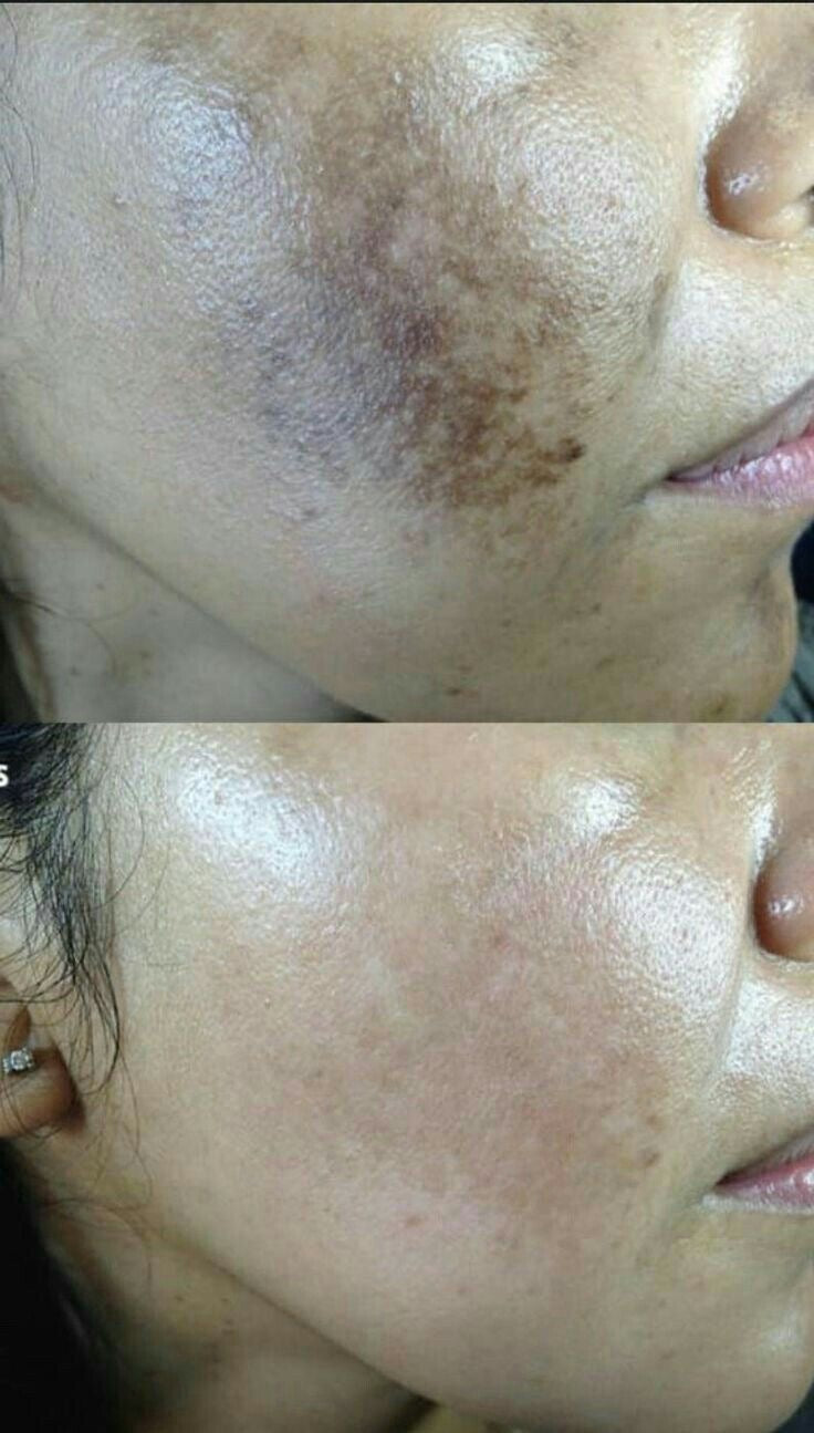 Anua Niacinamide 10% + TXA 4% Serum SkinGlow