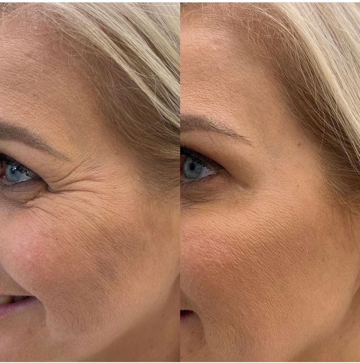 Medicube - Sérum anti-âge triple Collagen Ma boutique