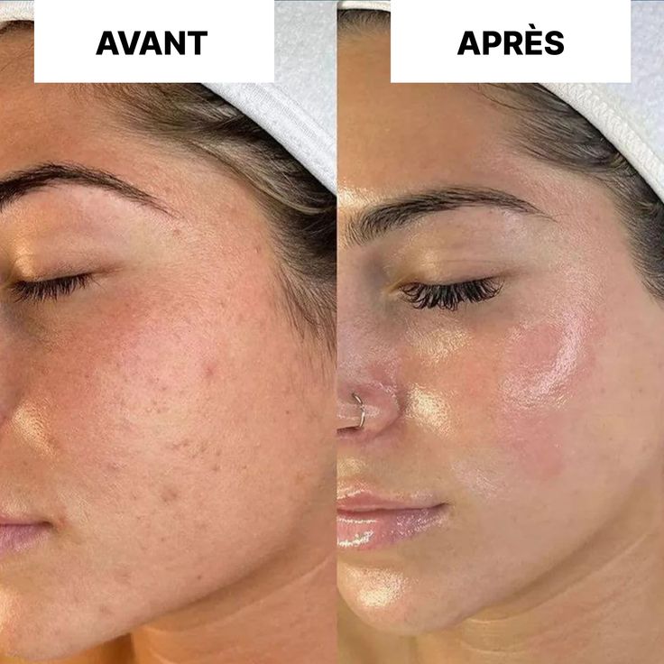 Medicube - Tonique au triple collagène SkinGlow