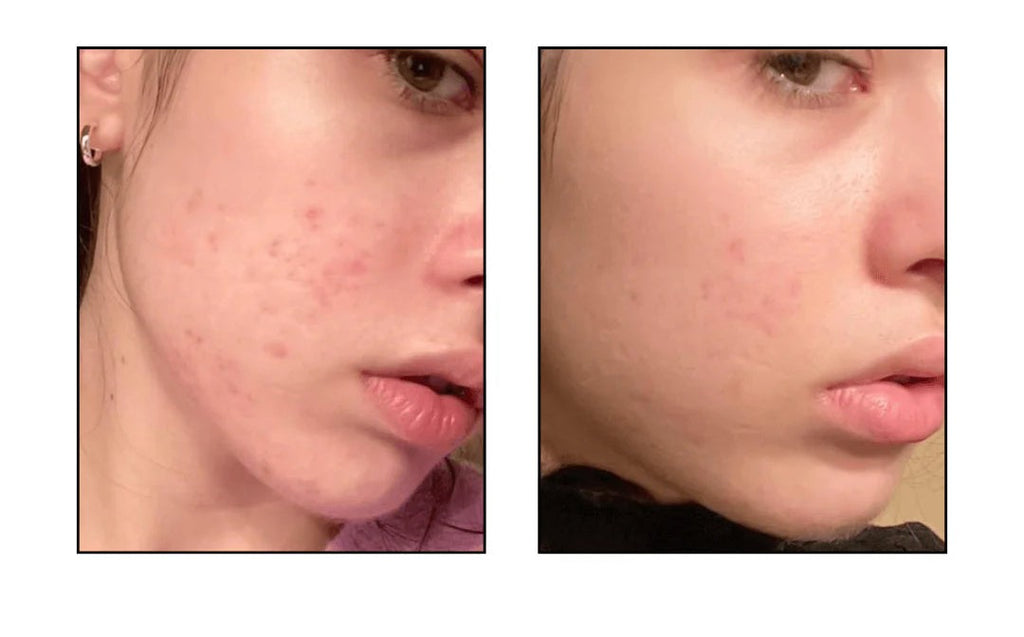 Anua Peach 77 Niacin Conditioning Milk SkinGlow