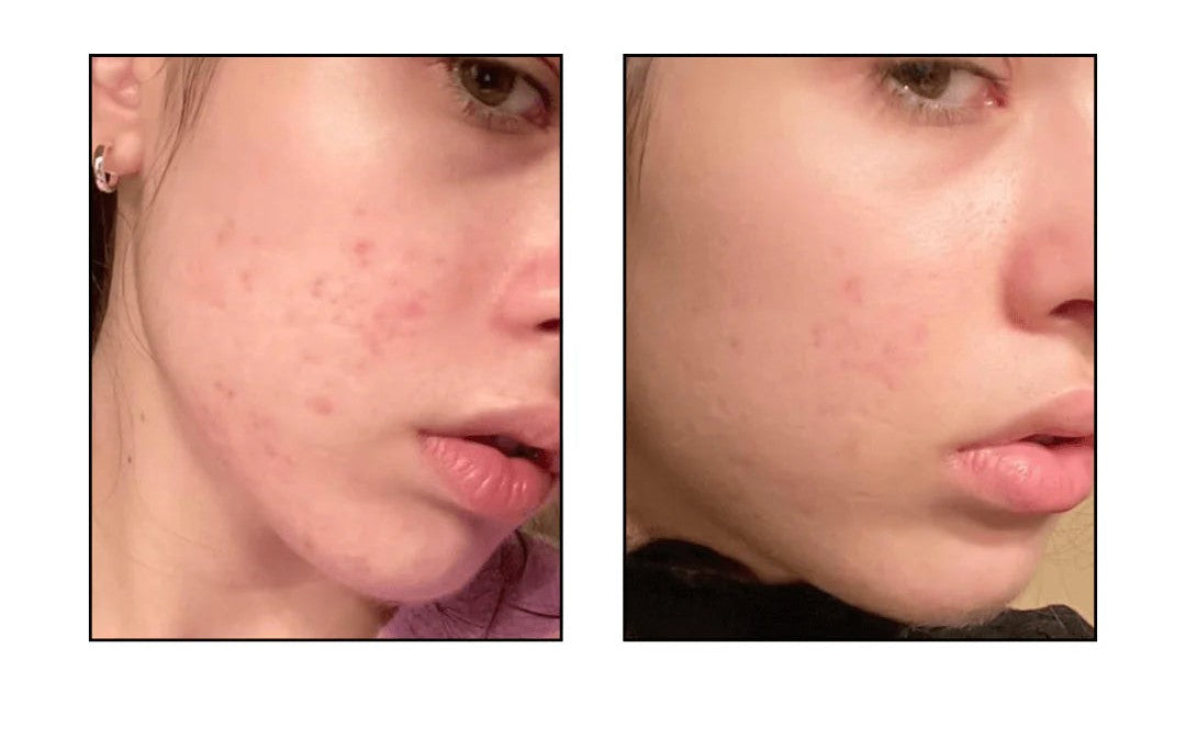 Anua Peach 77 Niacin Conditioning Milk SkinGlow