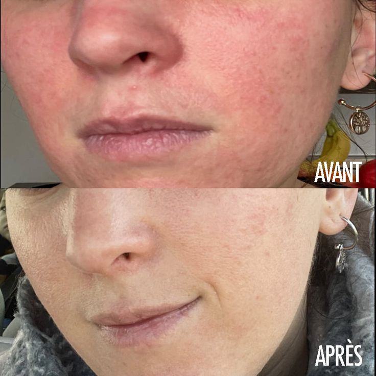 Dr Althea 147 Hypoallergenic Repair Cream SkinGlow