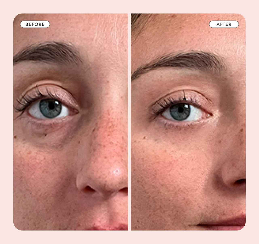 Mary&May Crème contour des yeux à l'acide tranexamique et au glutathion