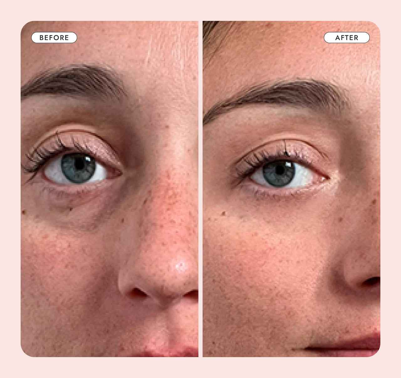 Mary&May Crème contour des yeux à l'acide tranexamique et au glutathion