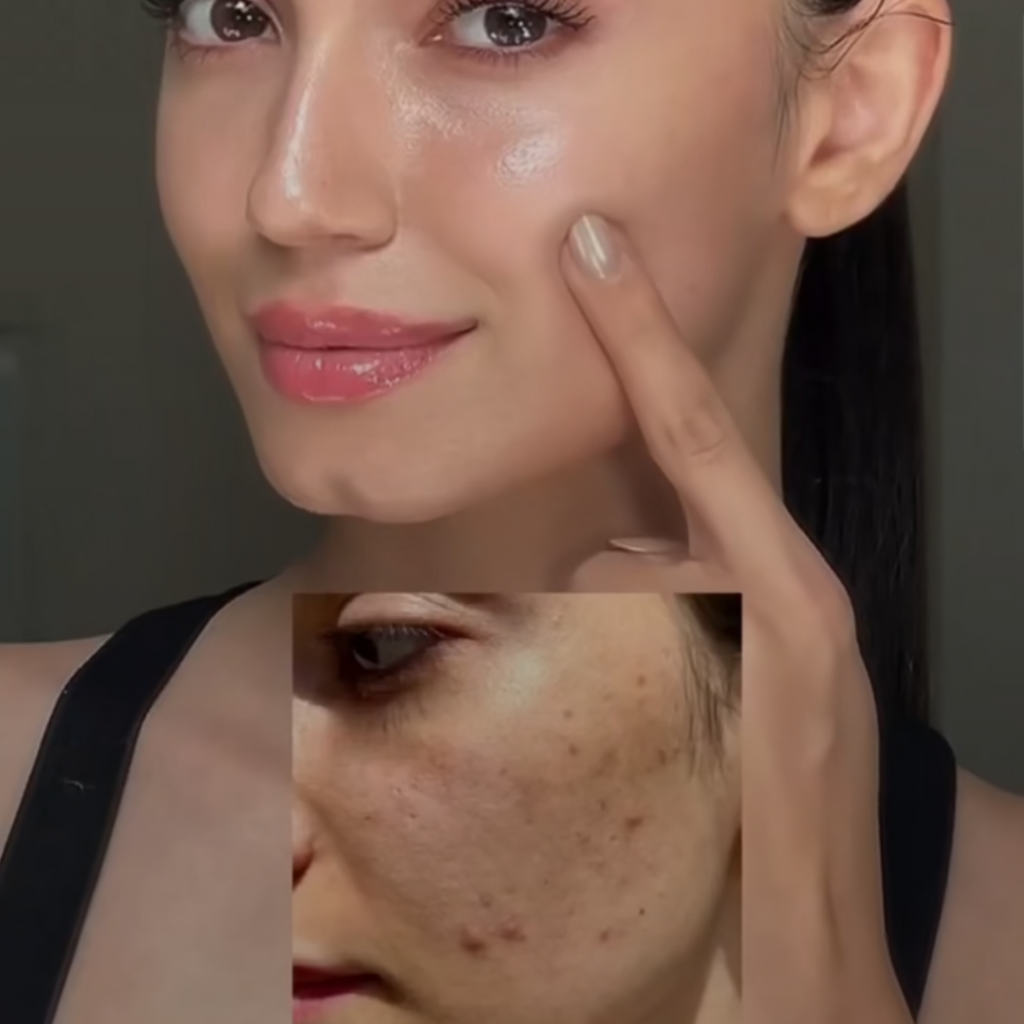 Anua Heartleaf LHA Moisture Peeling Gel SkinGlow