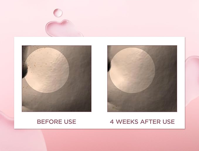 Skin1004 Madagascar Centella Poremizing Fresh Ampoule SkinGlow