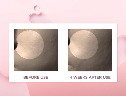 Skin1004 Madagascar Centella Poremizing Fresh Ampoule SkinGlow