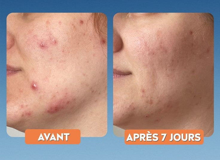 Anua Hyaluronic Acid 8+ Panthenol Cleanser SkinGlow