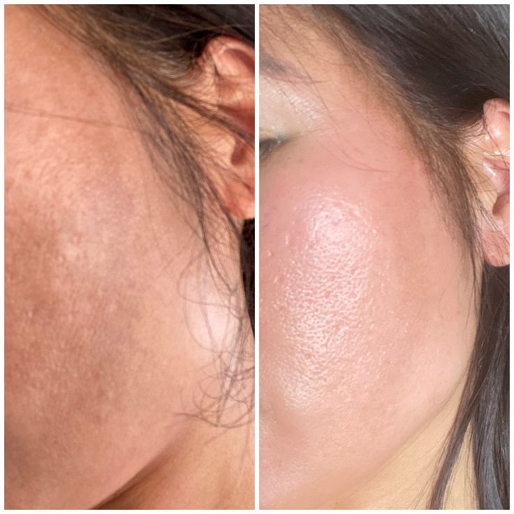 Medicube - Sérum éclat Glutathione SkinGlow