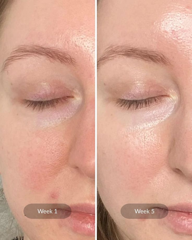 Dr Althea Squalane Silk Mask 01 SkinGlow