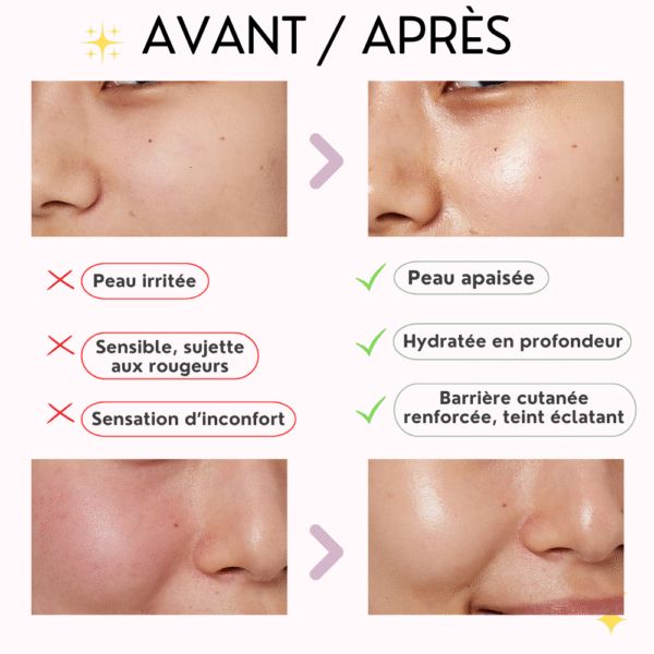 Anua Heartleaf Pore Clay Pack SkinGlow