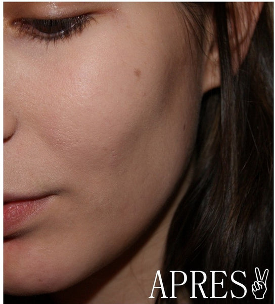 Après