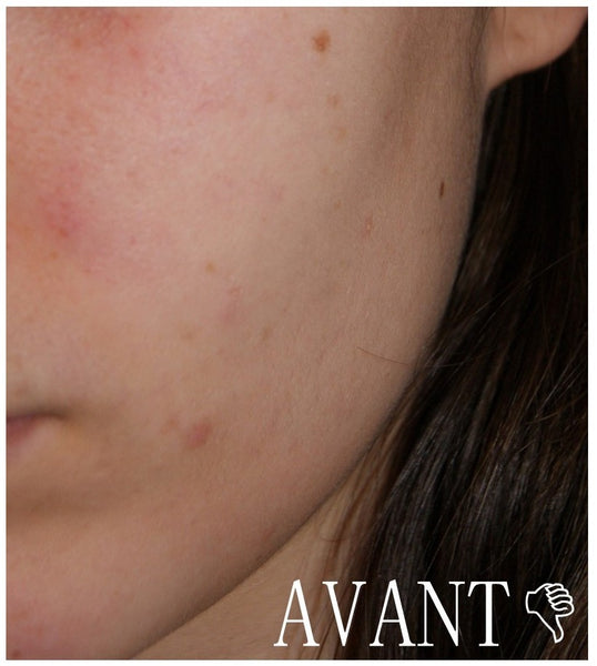 Avant